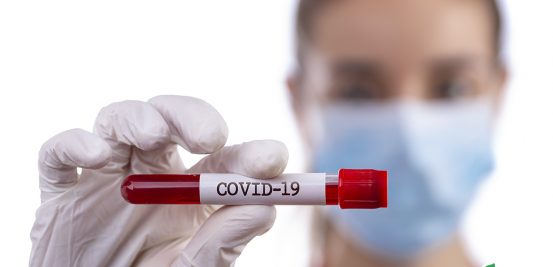 Coronavírus: os cuidados que adotamos 1